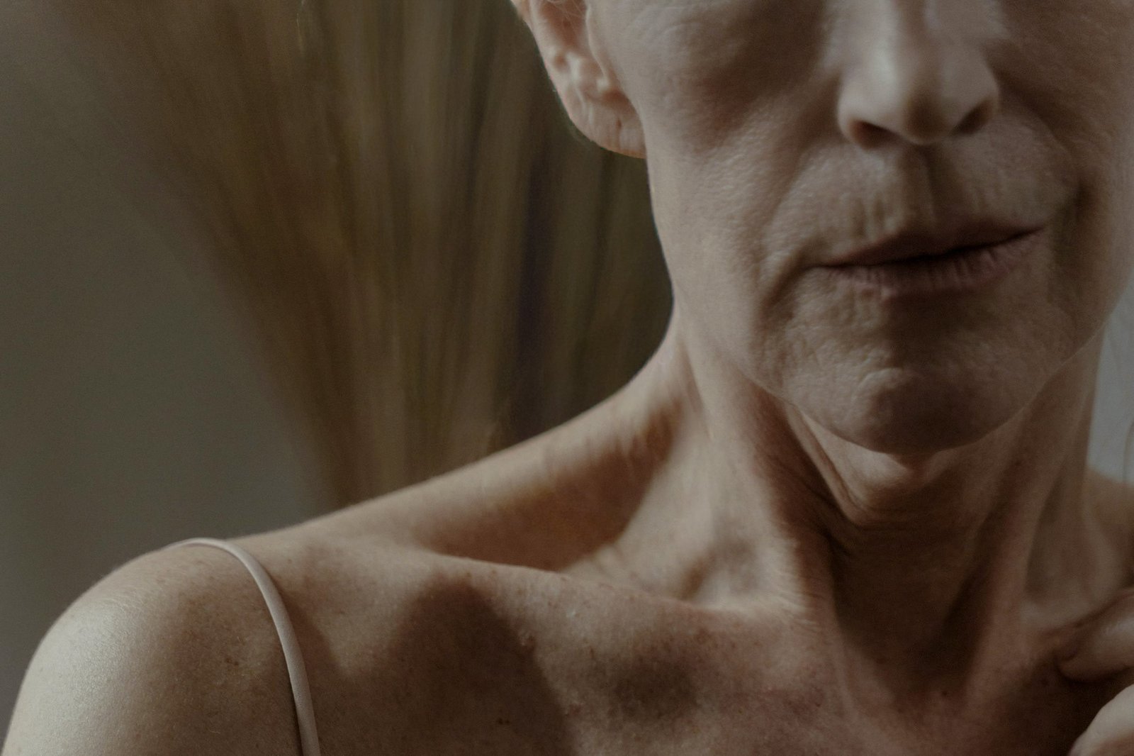 Rugas de Expressão: Diferença Entre Prevenção e Tratamento | Grupo Paula Chicralla Rugas de Expressão