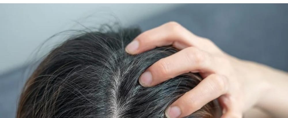Metrópoles — Tomar sol no cabelo ajuda a diminuir a caspa? Entenda se o efeito existe