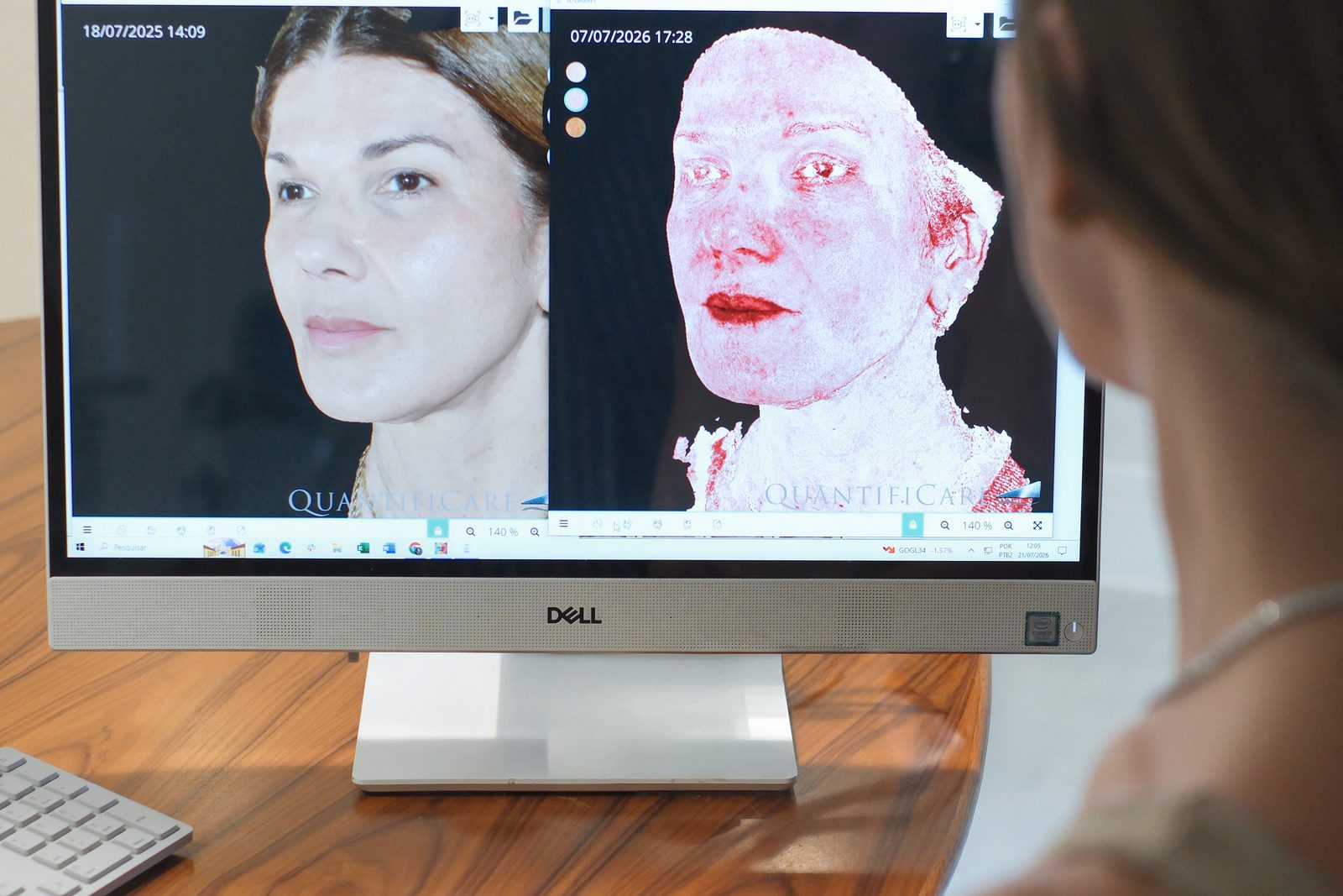 Análise Facial com Infravermelho