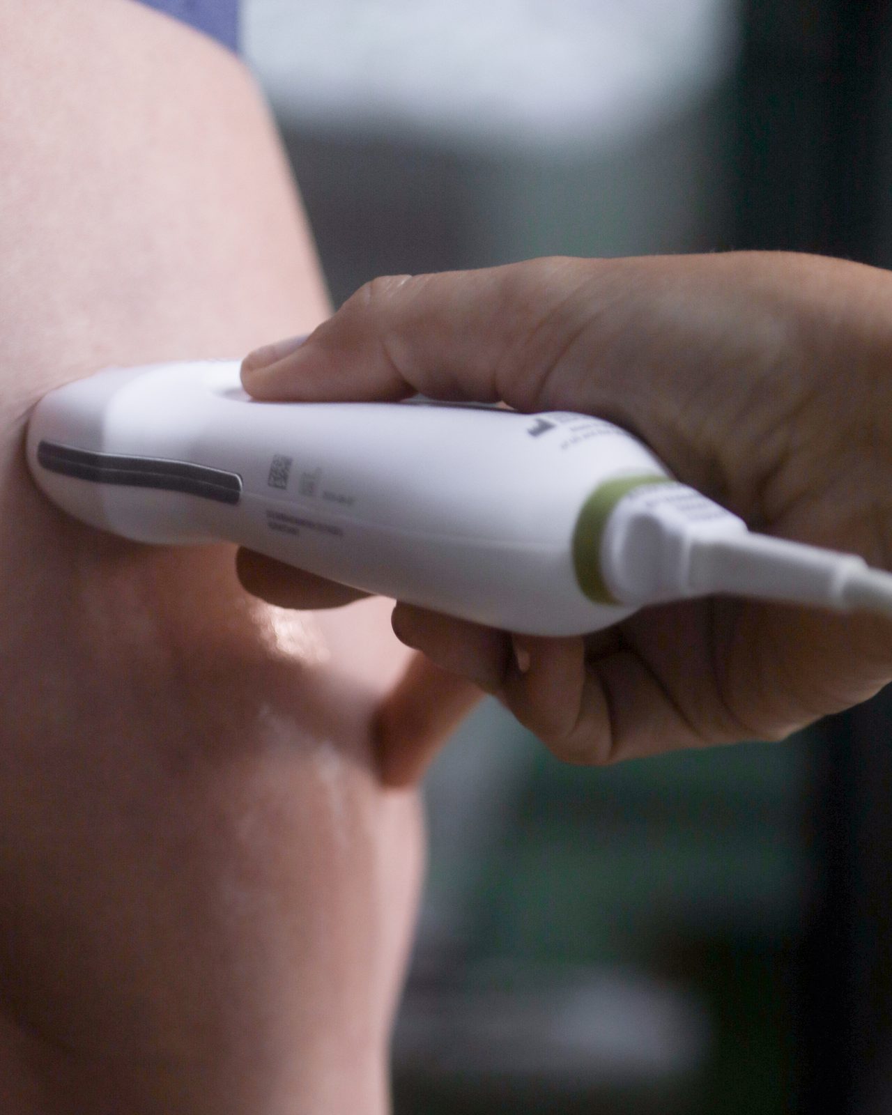 Ultrassom com Doppler das Pernas