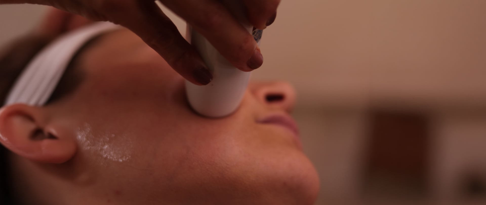 Procedimento com tecnologia dermatológica de precisão no Grupo Paula Chicralla