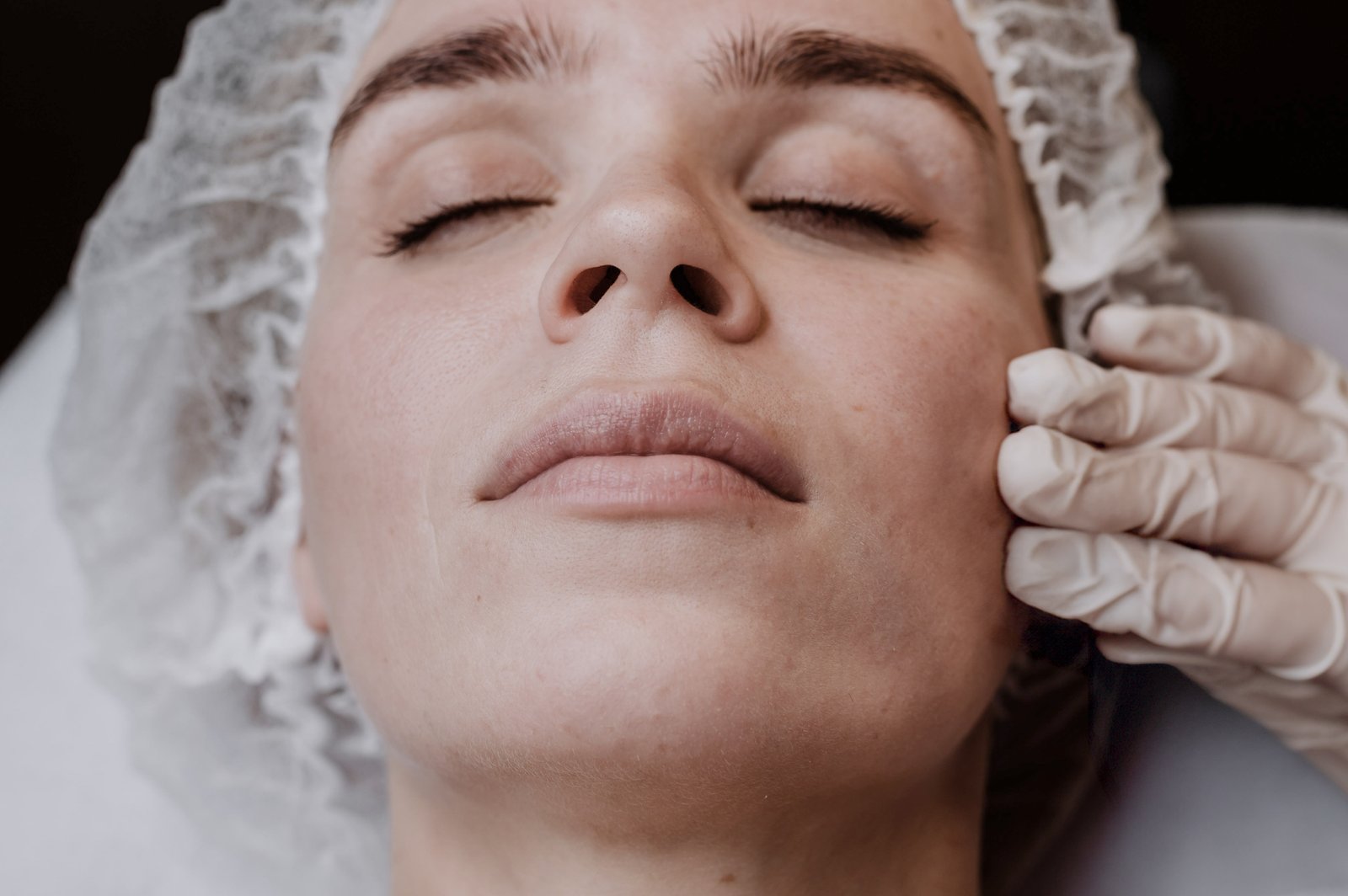 Exossomos autólogos prp facial